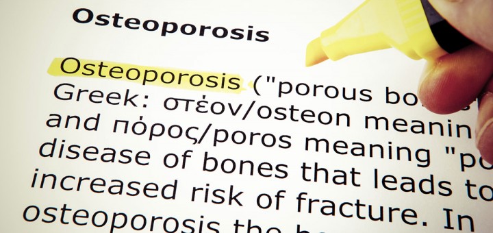 Four Ways for Seniors to Prevent Osteoporosis