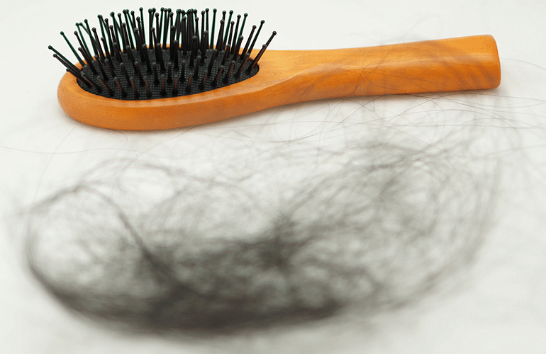 Hair Loss – Not Just a Man’s Problem