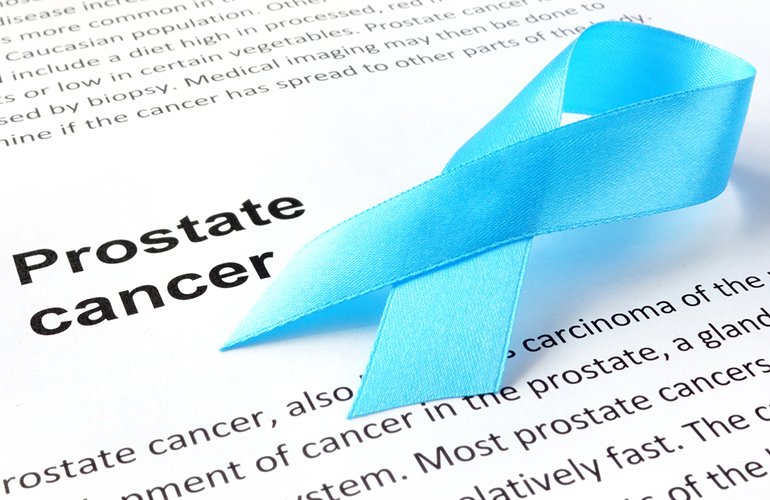 New Prostate Cancer Screening Guidelines