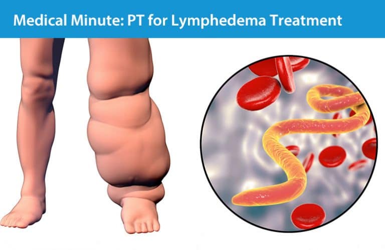 Medical-Minute-Lyphedema - Reliant Medical Group