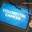Is it Time for Your Colon Cancer Screening?