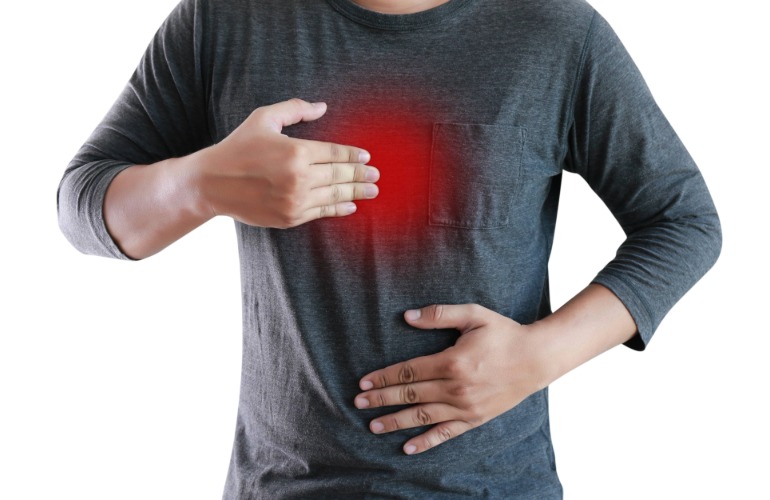 Burning Question: Heartburn and Your Treatment Choices