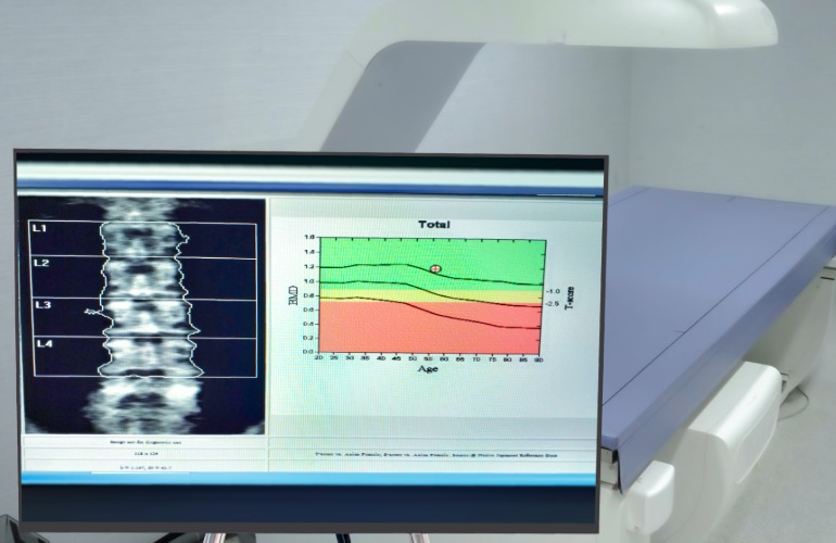 Learn More About Osteoporosis and Bone Density Testing